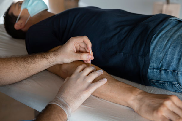 A man receives a trigger point dry needling session as a doctor places a small needle on his arm.